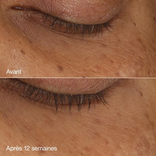 CLINIQUE-All About Eyes - Sérum Yeux Concentré Illuminateur CLINIQUE-All About Eyes - Sérum Yeux Concentré Illuminateur